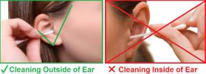 Cotton Buds can damage ears